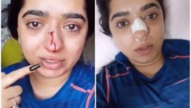 Photo of महिला ने जेमोटो कर्मचारी पर नाक तोड़ने का आरोप लगाया !